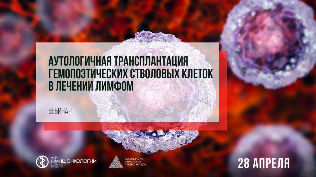 Вебинар «Аутологичная трансплантация гемопоэтических стволовых клеток в лечении лимфом»