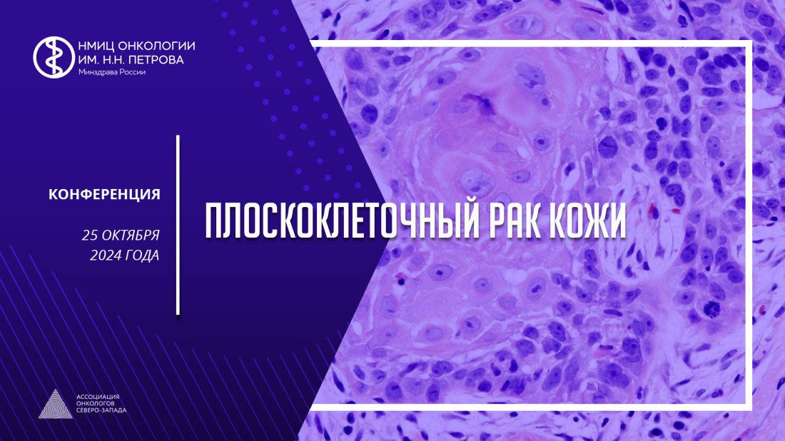 Конференция «Плоскоклеточный рак кожи»