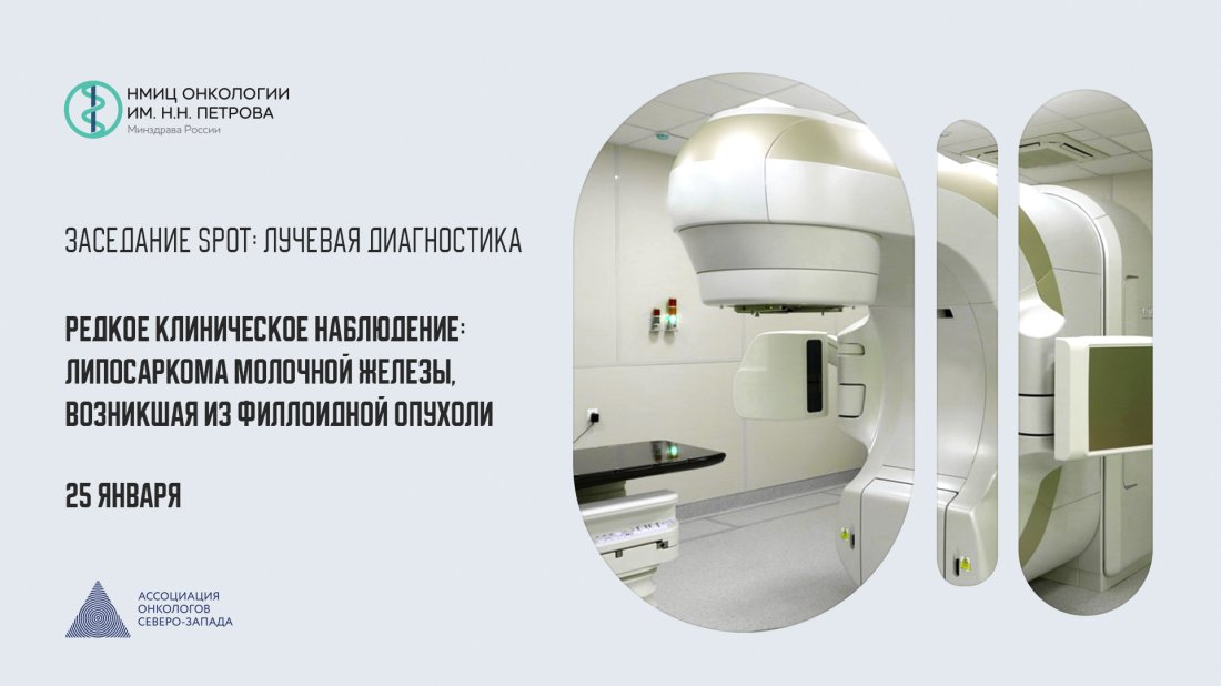 Вебинар «Заседание SPOT: Лучевая диагностика. Редкое клиническое наблюдение: липосаркома молочной железы, возникшая из филлоидной опухоли»