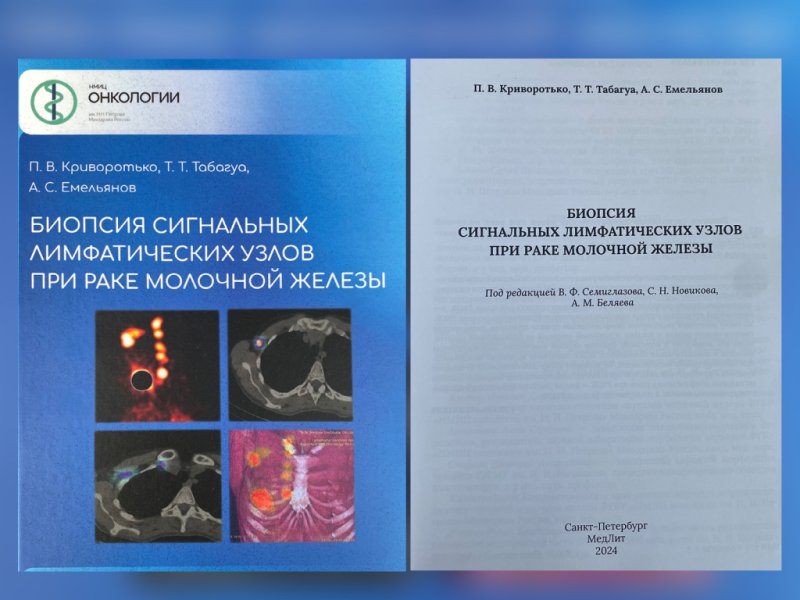 Лучший подарок — книга: монография о биопсии сигнальных лимфоузлов под редакцией В.Ф. Семиглазова вышла в свет в день его рождения