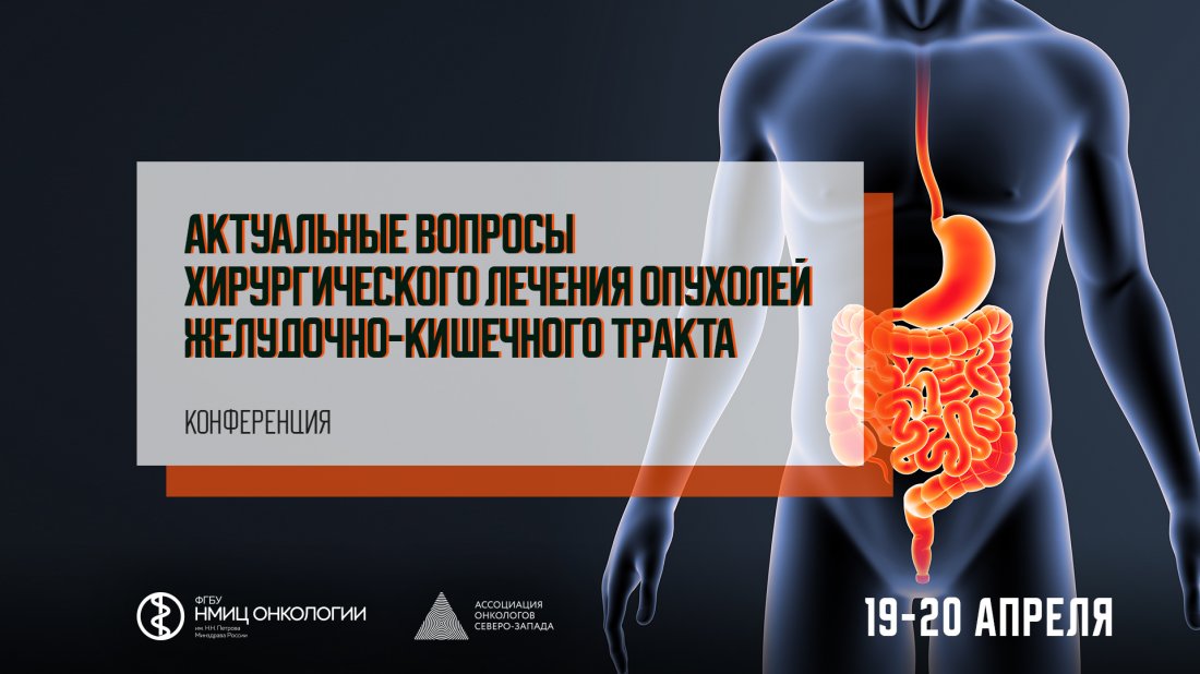 Конференция «Актуальные вопросы хирургического лечения опухолей желудочно-кишечного тракта»
