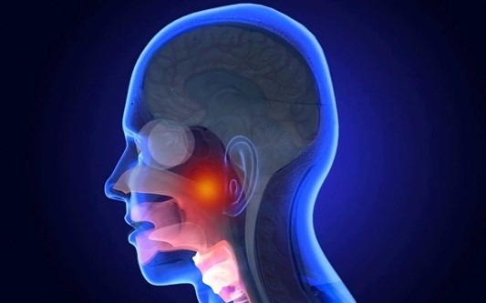 Рак носоглотки