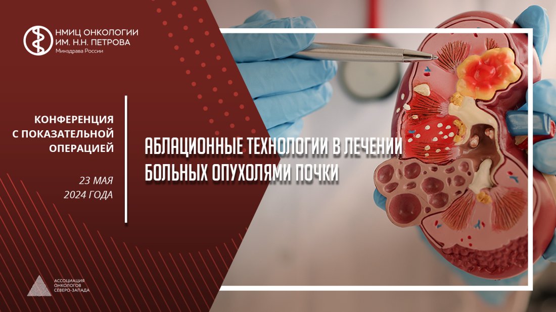 Конференция с показательной операцией «Аблационные технологии в лечении больных опухолями почки»