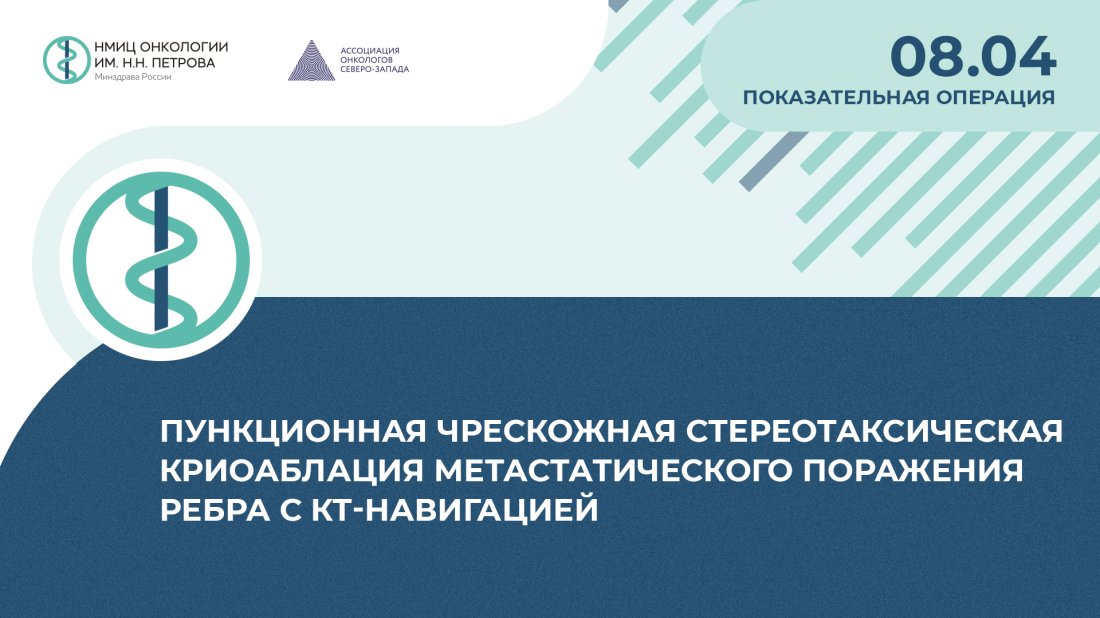 Показательная операция «Пункционная чрескожная стереотаксическая криоаблация метастатического поражения ребра с КТ-навигацией»