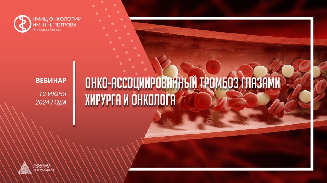Вебинар «Онко-ассоциированный тромбоз глазами хирурга и онколога»