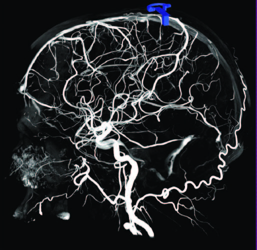 Пространственное разрешение