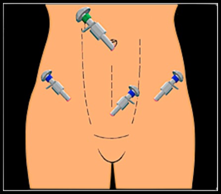 Другие методы лечения