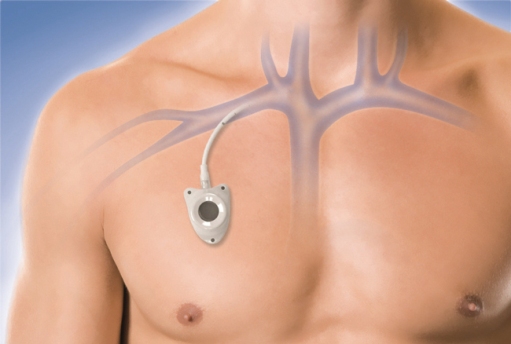 противоопухолевая терапия