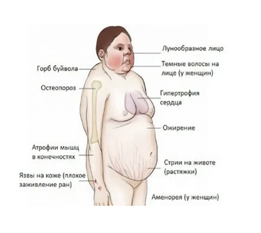 Гормонотерапия