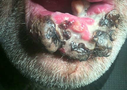 Фото рака губы