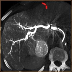 Этапы реконструкции и использования