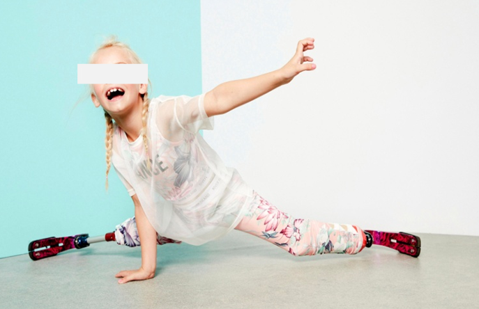 Рис. 8 Экзопротез нижних конечностей Рис. 8 Экзопротез нижних конечностей