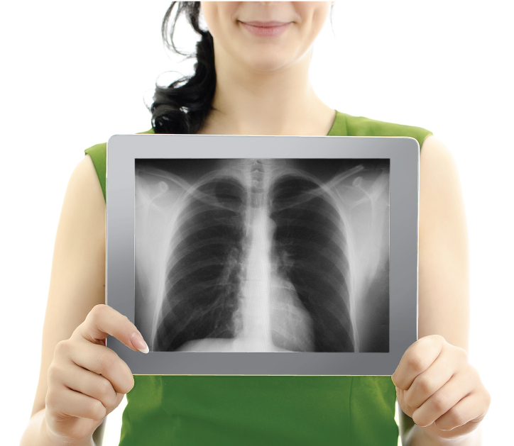 Рентгенография