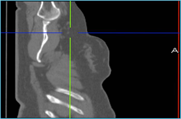 Рис. 1. Лучевая диагностика. Визуализация изменений морфологической структуры или анатомии
