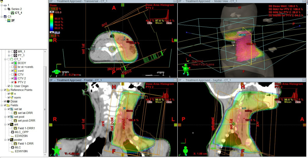 План лучевого лечения