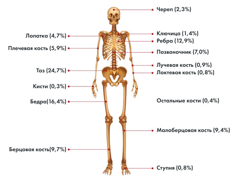 Локализация первичной опухоли саркомы Юинга Локализация первичной опухоли саркомы Юинга