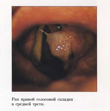 Методы диагностики