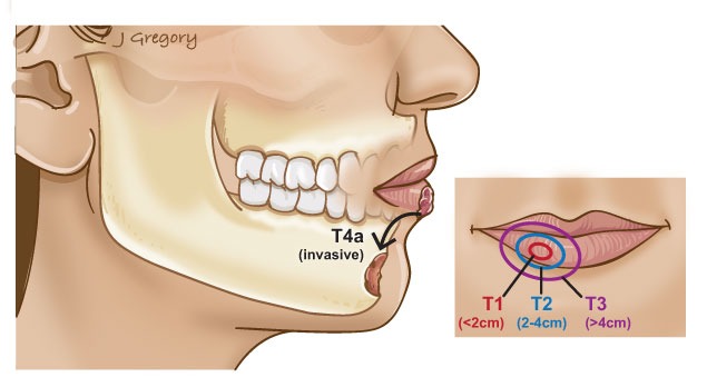 Классификация