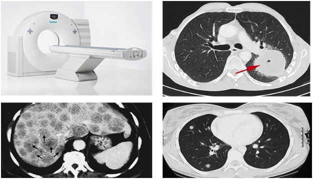 Компьютерная томография Компьютерная томография