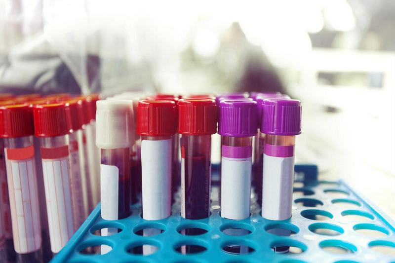 Анализы для диагностики заболеваний щитовидной железы