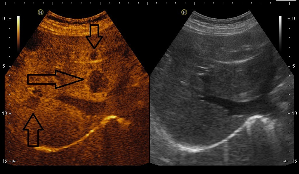 Режим эхоконтрастирования