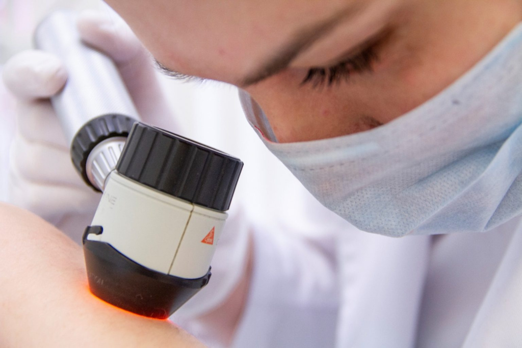 осмотр родинок