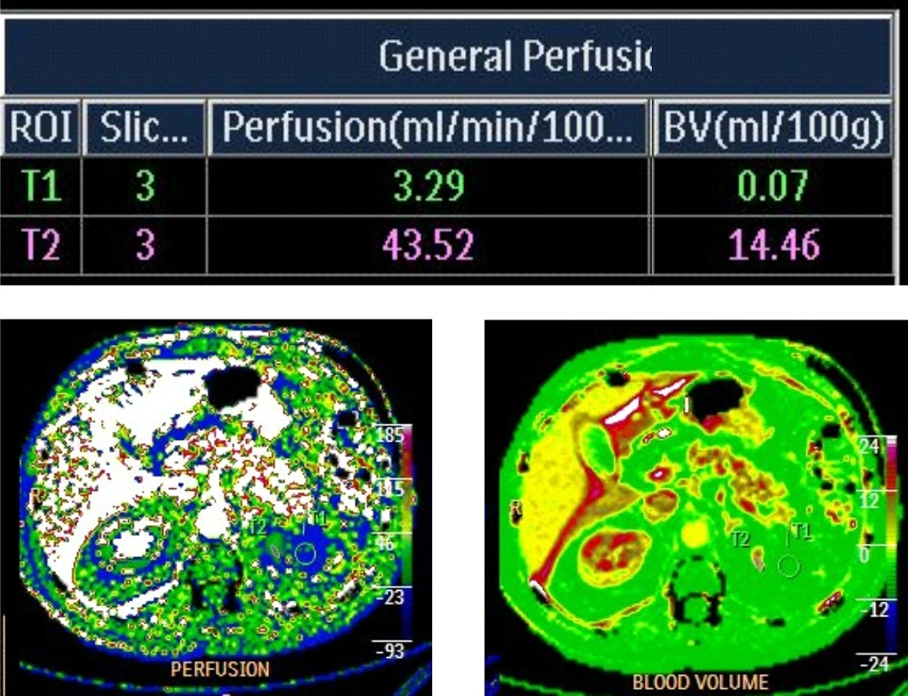 Хирургическое лечение