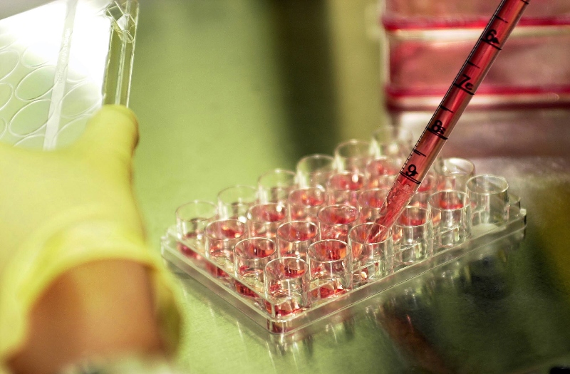 химиотерапия