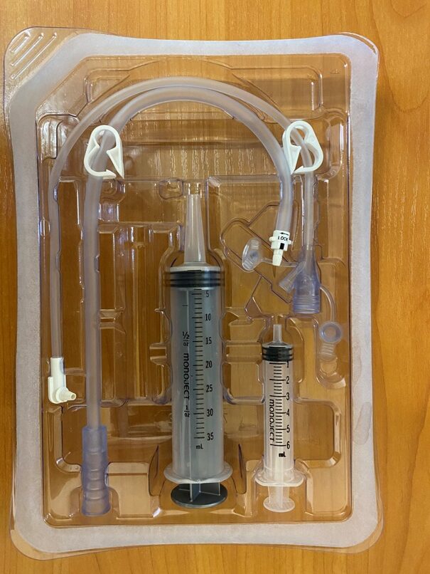 Чрескожная гастростома