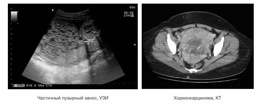 ПДиагностика