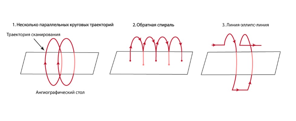 Возможные варианты ПДКТ-сканирования