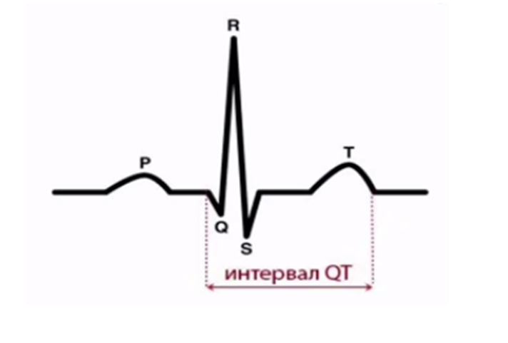 Интервал QT