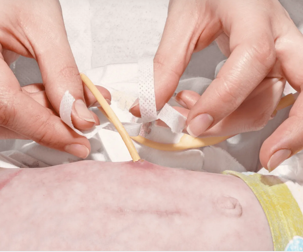 Как принимать таблетки через зонд или гастростому