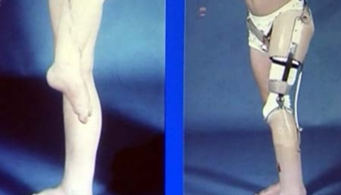 Рис.10 Ротационная пластика Рис.10 Ротационная пластика