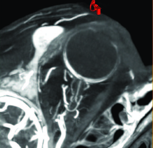 Пространственное разрешение