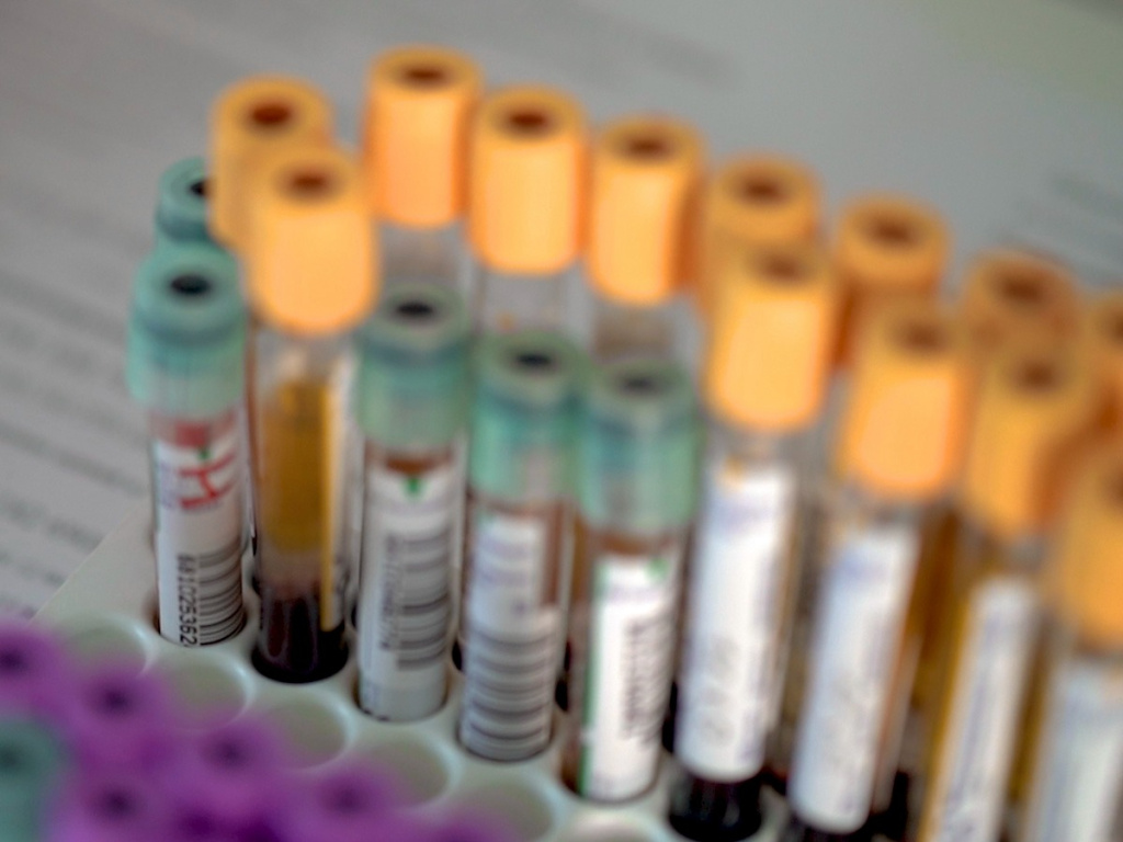 Все индивидуально