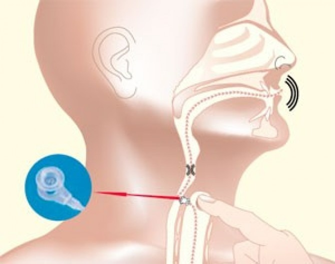 Хирургическая методика