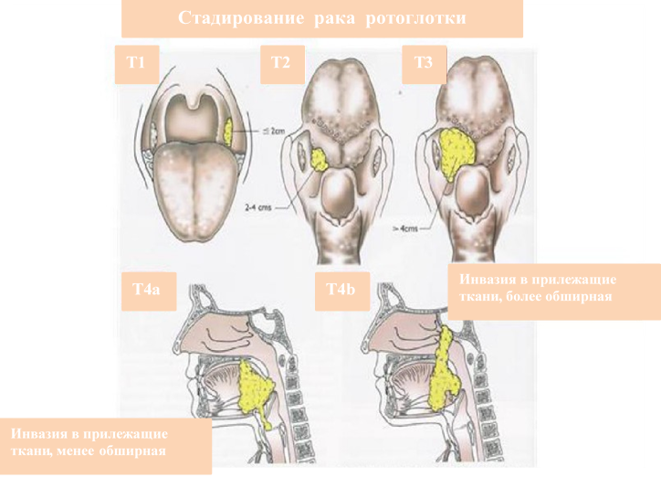 Стадирование