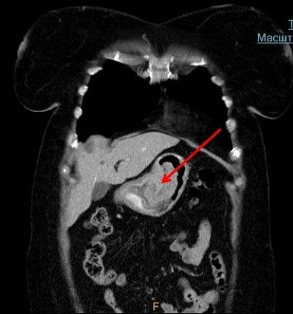 Методы диагностики