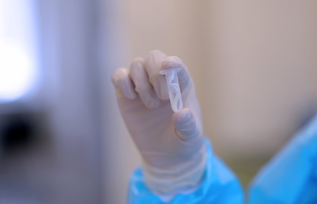 исследования коронавирусной инфекции