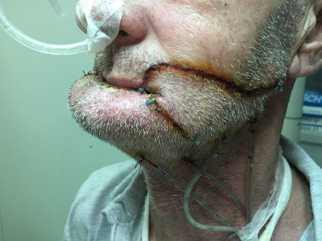 Методы лечения