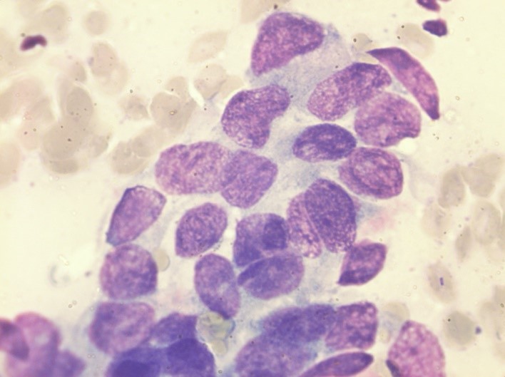 Рис.1 Цитологическое исследование Рис.1 Цитологическое исследование