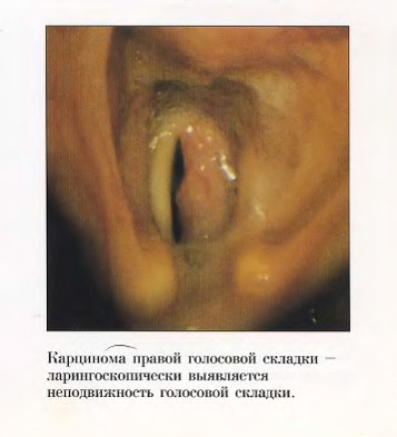 Методы диагностики