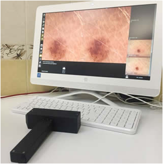 цифровая дерматоскопия
