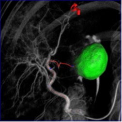 Этапы реконструкции и использования
