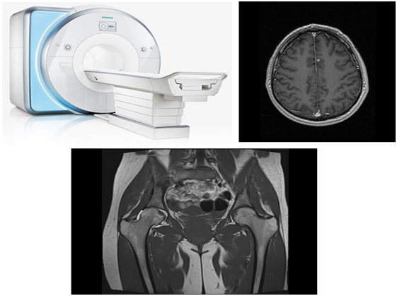 Магнитно-резонансная томография Магнитно-резонансная томография