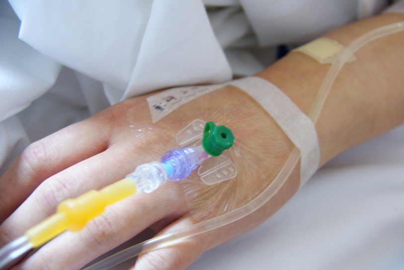 химиотерапия