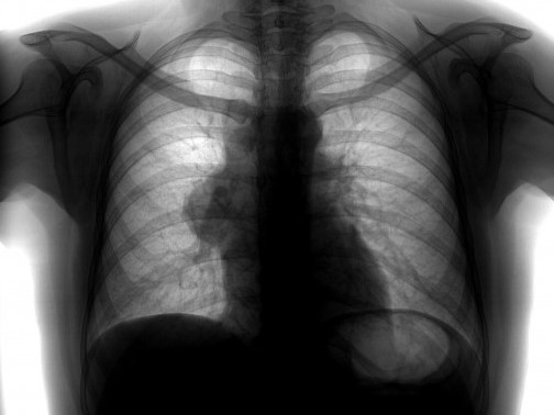 Диагностика Диагностика