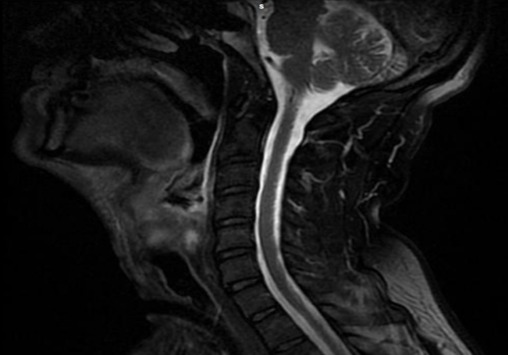 Рентгенологические методы исследования