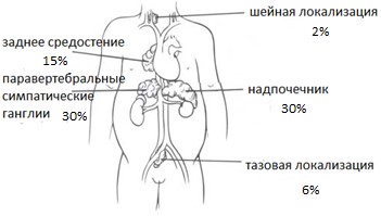 Рис. 1. Локализация нейробластомы